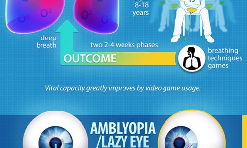 How video games can improve your health infographic