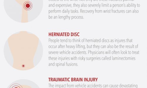 Top Seven Injuries Caused By Car Accidents