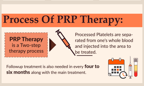 The Facts About PRP