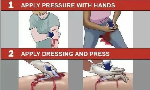 stop the bleed save a life