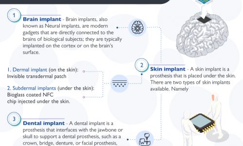 Kinds Of Implanted Microchips