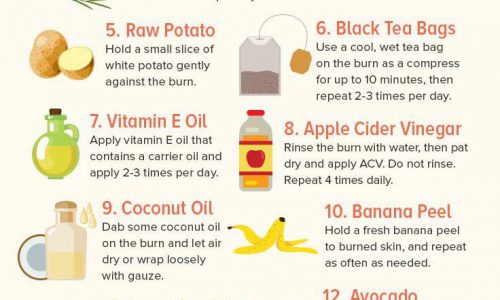home remedies for burns
