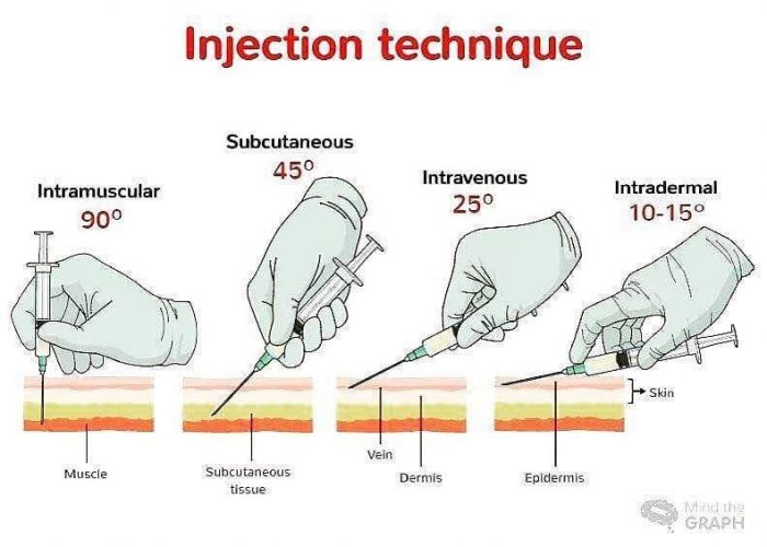 Injection Techniques